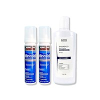 2 Minoxidil Espuma Kirkland + SHAMPOO SIN SAL ANTICAÍDA 250ML