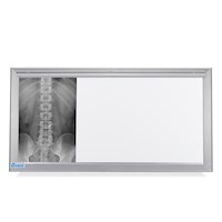 Negatoscopio Fluorescente de 3 Campos en Acero Integro