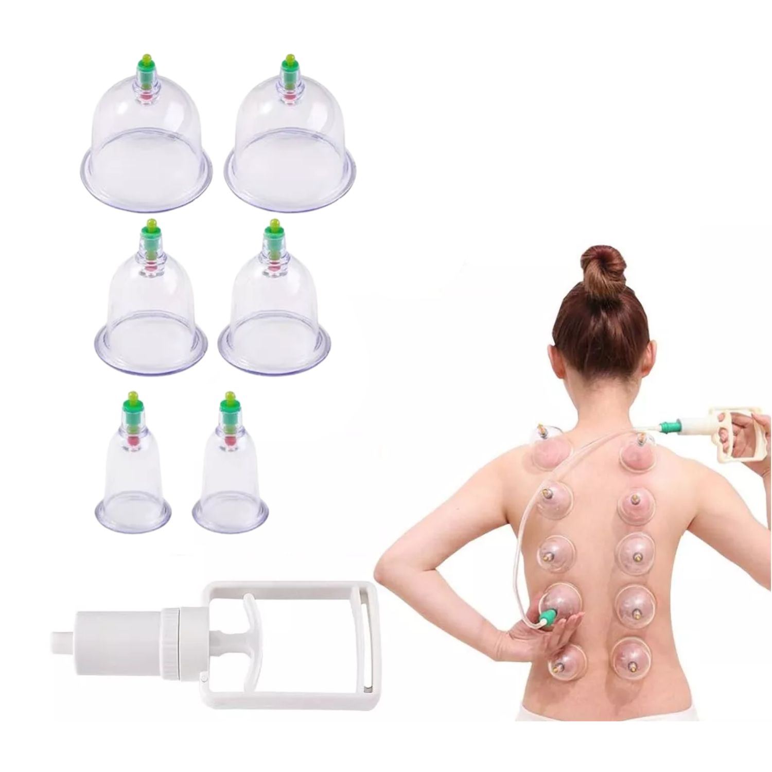 Kit Ventosas Chinas 6 Piezas con Bomba Masaje Terapéutico Alivio Dolor Muscular Circulación Anticelulitis
