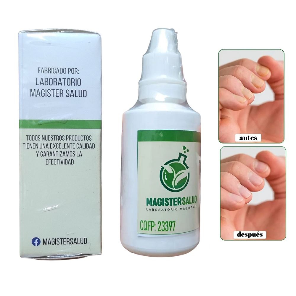 Terbinafina Gotas para hongos en las uñas y pies