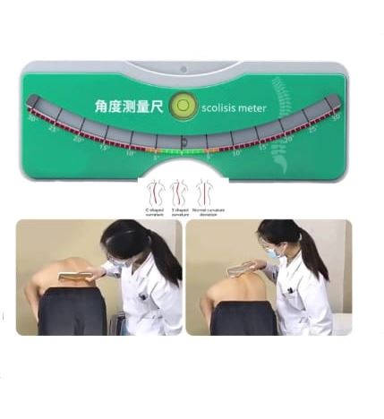 REGLA MEDICION DE ESCOLIOSOS